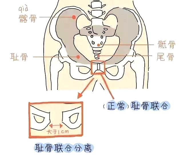 盆底肌康復(fù)治療儀，產(chǎn)后媽媽不再擔(dān)心