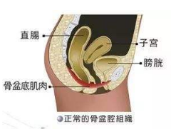 產后盆底肌怎么修復？你得做好盆底功能檢測