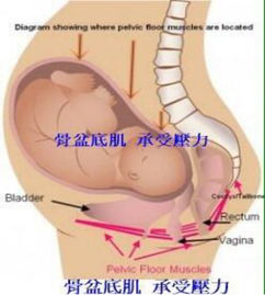 產(chǎn)后盆底康復(fù)治療開始后，出現(xiàn)陰道出血怎么破？