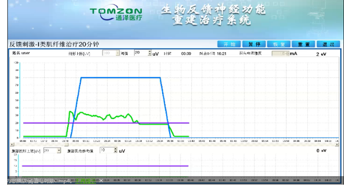 盆底康復(fù)治療怎么做？盆底康復(fù)治療肌電生物反饋治療儀的機(jī)理是什么？