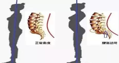 產(chǎn)后康復(fù)干預(yù)措施對(duì)產(chǎn)后修復(fù)的促進(jìn)作用研究