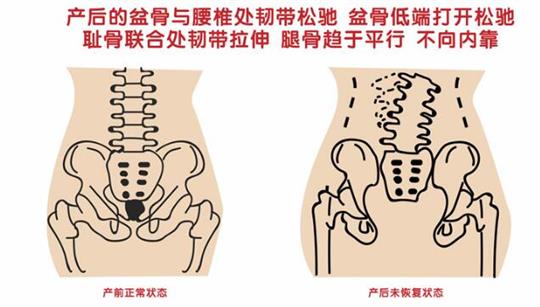 自從知道產(chǎn)后康復治療儀后，再也不怕腹直肌修復了