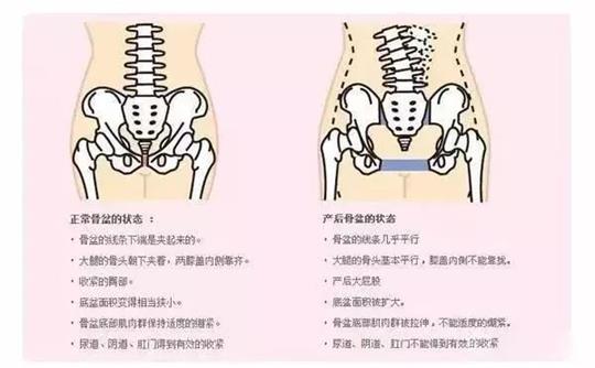 產(chǎn)后修復(fù)治療儀器對于腹直肌修復(fù)有效果嗎？