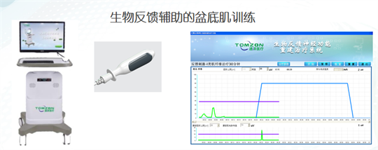 產(chǎn)后修復(fù)|盆底肌肉功能電刺激有什么作用？生物反饋呢？