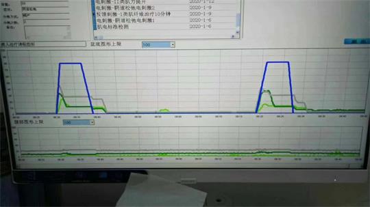 通澤子宮復(fù)舊治療儀器，痛經(jīng)不再是問題