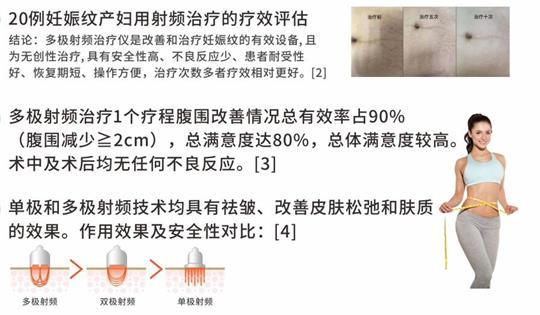 通澤產(chǎn)后塑形儀器，多極射頻破解辣媽逆齡秘訣