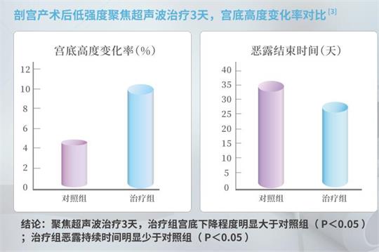 產(chǎn)后子宮修復儀器，重回少女身材