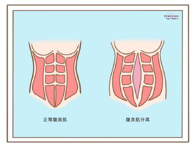 盆底康復(fù)治療儀效果到底怎么樣？