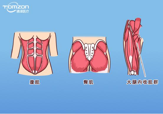 凱格爾運(yùn)動(dòng)該怎么做？盆底肌修復(fù)儀器還能用嗎？