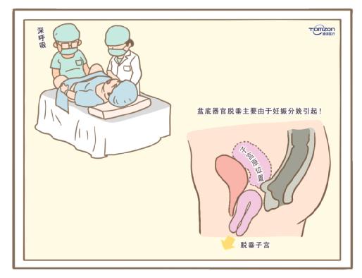 盆底康復治療儀